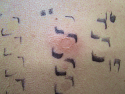 接触皮膚炎 かぶれ お知らせ 高木皮膚科 漢方皮膚科